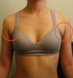 exercises...to fix for a strapless dress! truth about cellulite