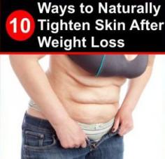 10 Ways to Naturally Tighten Skin After Weight Loss  #WeightLoss #LoseWeightForWomen #Lose10Lbs #VenusFactorWeightLoss