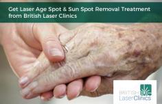 If you are suffering from age spot & sun spot problems, then British Laser Clinics is a place where you can get safe, efficient and cost-effective solution to meet your various requirements. For getting more details about our services, visit our website.