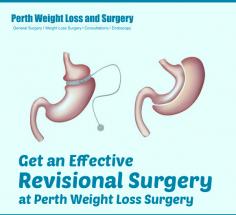 Perth Weight Loss Surgery provides the various treatments for the patients who have regained their weight or got some complications from their previous surgery. No matter, whether you need transformation from one type of Bariatric surgery to another or revising the same surgery again, we are happy to assist you at every step. 