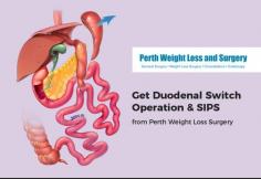 Reduce your weight with the help of procedures provided by the team of Perth Weight Loss Surgery. We will treat you with the SIPS procedure as this helps you with excess of weight loss from your body. To know more about this procedure, visit our website now!