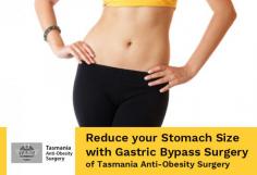 Gastric Bypass Surgery helps obese patients to lose 60-70% of total weight within a time period of 24 months. After having this weight loss surgery, the patient experiences a feeling of fullness by consuming less food. Change your lifestyle by considering this procedure from the specialists at Tasmania Anti-Obesity Surgery. 