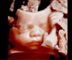 Are you eager to see how your baby looks like inside the womb? Wants to know its gender before its birth? If yes, Amazing Scan is the ultimate destination for you.