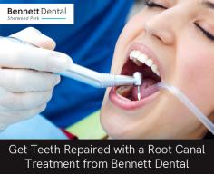 Want to save a decayed tooth? A root canal treatment from Bennett Dental may be the solution. In some cases, root canals can allow you to keep the tooth rather than having it removed.