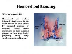 emorrhoids are swollen, inflamed blood vessels in the lower rectum or anus caused by increased pressure or straining during bowel movements, or from increased pressure on these veins during pregnancy, lifting heavy weights, severe coughing, etc.