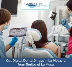 At Smiles of La Mesa, we use high-quality, digital x-rays to ensure our patients are safe from radiation. Call 619-343-3129 to book an appointment today!