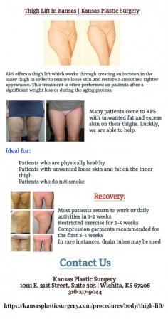 KPS offers a thigh lift which works through creating an incision in the inner thigh in order to remove loose skin and restore a smoother, tighter appearance.
