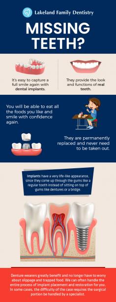 At Lakeland Family Dentistry, we offer our patients a great and natural looking solution for missing teeth. Our dentists give you an ultimate confidence to smile again with dental implants. 