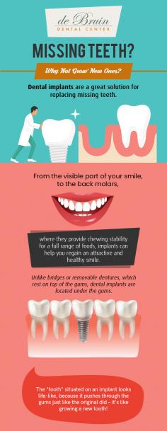 Missing teeth? Say goodbye to missing teeth as de Bruin Dental Center is here to help you with implant dentistry solutions in Reno, NV. We provide excellent quality and natural-looking dental implants to replace the missing teeth.