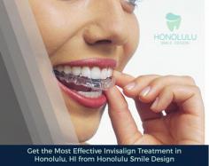 When it comes to a straighter smile, invisalign is an innovative solution offered by Honolulu Smile Design. We utilize advanced 3-D computer-imaging technology to adjust the overcrowding, widely spaced teeth, overbite, underbite, and even crossbite. 
