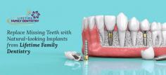 Lifetime Family Dentistry is a full-service dental practice, specialized in implant dentistry in Collinsville, CT. We offer the best quality dental implants, which are the perfect solution to recapture a full smile and improve the chewing capability. 
