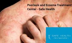 Call Safe Health Center is a Dermatology clinic in Mt. Pleasant and East Lansing, Michigan at @ (855) 472-3300 now for Eczema Treatment services you can rely on! Dr. Fatteh has many different tools and techniques to help you manage your eczema. For more information, visit our website.