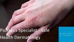 Safe Health Dermatology provides psoriasis treatment in Mt. Pleasant, and offers a wide range of treatment options for our patients living with psoriasis. Schedule a visit with Dr. Fatteh today to discuss treatment options. You can book a visit online or by phone.