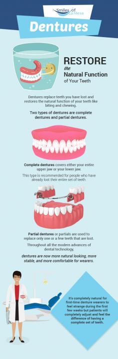 Have you lost your entire set of teeth? Get in touch with Smiles of La Mesa. We specialize in providing complete dentures to restore the natural beauty and functionality of missing teeth. We offer custom made dentures to fit perfectly in the patient’s mouth. 