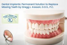 Engage with Gregg L. Kassan, D.D.S., P.C. for your implant dentistry needs in Montclair, VA. Whether you have one or more missing teeth, our implants will be permanently placed in the mouth to give you a solid smile. 