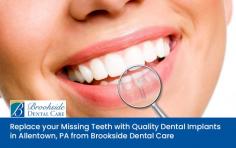 Choose Brookside Dental Care when looking for a reliable dental implant service provider in Allentown, PA. We use the latest techniques for dental implant procedures, helping our patients to replace their missing or worn out teeth.