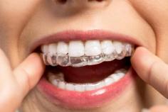 Invisalign trays are invisible! They are completely clear so they don’t detract from your face or smile. If you need reliable Invisalign service, then contact Dental Touch Atlanta today at (404) 973-2377. 
http://www.dentaltouchatlanta.com/invisalign-lithonia