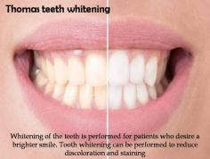Whitening of the teeth is performed for patients who desire a brighter smile. Tooth whitening can be performed to reduce discoloration and staining.