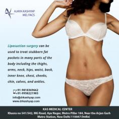Liposuction is cosmetic surgery in which deposits of fat are removed to reshape or reduce one or more areas of the body. Common areas targeted include thighs, buttocks, abdomen, arms, neck and under the chin. 
Dr. Ajaya Kashyap is US board certified plastic surgeon and experienced in performing liposuction surgery.During your consultation, Dr. Kashyap will help determine which technique is best for you. Call Dr. Kashyap today at (981) 836-9662 to schedule your consultation.
For any kind of enquire about, liposuction surgery please complete our contact form https://www.drkashyap.com/get/consultation-process-form.html
Call: +91-9818963662, +91-9958221983
Now New Address: Khasra no 541/542, MG Road, Aya Nagar, Metro Pillar 184, Near the Arjan Garh Metro Station, New Delhi 110047 (India)
#liposuction, #vaserliposuction, #liposuctioncost, #liposuctionIndia, #cosmeticsurgery, #plasticsurgery, #plasticsurgerycost, #DrAjayaKashyap
