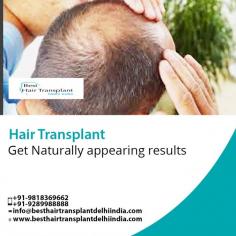 Need hair transplant surgery in Delhi, India. Meet Triple American Board Certified surgeon Dr. Ajaya Kashyap.
Their clinic is super clean and is following proper hygiene standards. Even in times of COVID -19.
For any kind of enquire about, hair transplant procedure please complete our contact form https://www.besthairtransplantdelhiindia.com/contact-hair-transplant-surgeon.html
Call: +91-9818963662, +91-9289988888
Send Your Query: info@besthairtransplantdelhiindia.com
Now New Address: Khasra no 541/542, MG Road, Aya Nagar, Metro Pillar 184, Near the Arjan Garh Metro Station, New Delhi 110047 (India)
#HairTransplant #HairTransplantSurgeon #Eyebrow #Eyelash #Beard #Moustaches #CosmeticSurgery #PlasticSurgeon #Drkashyap #Delhi #India
