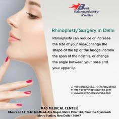 Nose job in Delhi, India is technically called Rhinoplasty and it is a surgical procedure that alters the shape of the nose to either improve its contour or to improve its functionality.
For more info visit www.bestrhinoplastyindia.com or call now on 9958221982 to book your consultation.
Now New Address: Khasra no 541/542, MG Road, Aya Nagar, Metro Pillar 184, Near the Arjan Garh Metro Station, New Delhi 110047 (India)
#noselift #surgeon #prettynose #nose #selfie #beauty #Asian #ethnicrhinoplasty
