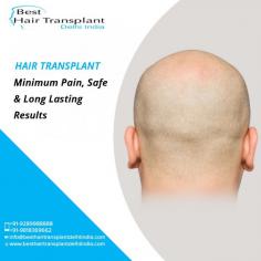 KAS medical Center has experienced surgeon and also have many years of experience in this field. If you are looking for the Hair transplant in Delhi then you can undoubtedly go with KAS medical Center.
To schedule an appointment please call +91-9958221983.
Visit: https://www.besthairtransplantdelhiindia.com
#HairTransplant #HairTransplantSurgeon #Eyebrow #Eyelash #Beard #Moustaches #CosmeticSurgery #PlasticSurgeon #Drkashyap #Delhi #India
