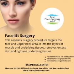 Facelift  - A more three dimensional approach is used for facelifts  and facial rejuvenation addressing lifting of tissues as well as volume replacement.
For more info visit www.bestfacesurgeryindia.com or call now on 9958221982 to book your consultation.
Now New Address: Khasra no 541/542, MG Road, Aya Nagar, Metro Pillar 184, Near the Arjan Garh Metro Station, New Delhi 110047 (India)
#midfacelift #fullfacelift #beautiful #face #SMAS #facelift #faceliftsurgery #faceliftsurgeon #rhytidectomy #cosmeticsurgery #plasticsurgeon
