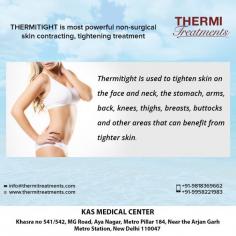 ThermiTight is used to tighten skin on the face and neck, the stomach, arms, back, knees, thighs, breasts, buttocks and other areas that can benefit from tighter skin
For more details and see before & after our national & international patients. 
To schedule an appointment please call +91-9958221983.
Visit: https://www.thermitreatments.com/thermitight.html
Now New Address: Khasra no 541/542, MG Road, Aya Nagar, Metro Pillar 184, Near the Arjan Garh Metro Station, New Delhi 110047 (India)
#thermitight #skintightning #nonsurgical #jowls #doublechin #armlift #facelift #necklift #breastlift #thighlift #kneelift
