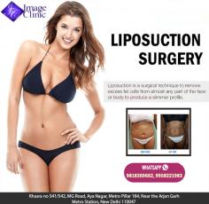 South Delhi plastic surgeon Dr. Ajaya Kashyap, who specializes in cosmetic plastic surgery. For more details about Liposuction Surgery visit:
https://www.imageclinic.org/liposuction.html

Whatsapp Direct Link :
https://api.whatsapp.com/send?phone=919818369662
Now New Address: Khasra no 541/542, MG Road, Aya Nagar, Metro Pillar 184, Near the Arjan Garh Metro Station, New Delhi 110047 (India)

#Liposuction #Abdomen #Thighs #Hips #VaserLiposuction #BodyJetLipo #KASMedicalCenter #DrAjayaKashyap #Medspa #Delhi #India #BoardCertifiedPlasticSurgeon 
