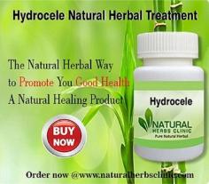 Professionals of Natural Herbs Clinic have called it as one of the helpful Natural Remedies for Hydrocele options available all around the world.
