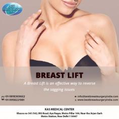 Loose and sagging breasts concern women. This can be due to weight fluctuations, pregnancy, aging, or may be heredity. Breast lift surgery will help you to tighten and lift the breasts, to give a more youthful appearance.
For more info visit www.bestbreastsurgeryindia.com or call now on 9958221983 / 81 to book your free consultation.
#BreastLift #Mastopexy #BreastLiftSurgery #Beforeandafter #DrKashyap #CosmeticSurgery #PlasticSurgeon #Delhi #India
