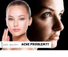 Get customized, effective and long term acne treatment plans from leading dermatologist for Acne in Lansing & Mt. Pleasant. Safe Health PC has the best dermatologist for acne, offering acne treatment designed to put an end to any breakouts, avoids scarring and skin discoloration. 