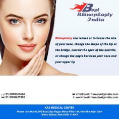 A nose job (technically called a rhinoplasty) is surgery on the nose to change its shape or improve its function.
If you are thinking about getting a nose surgery, set up an appointment with your surgeon to discuss it. During that meeting, talk about your goals and tell the doctor what bothers you about your nose and how you would like to change it.
For more details and see before & after our national & international patients. 

Call: +91 995 8221 982
E-mail: info@bestrhinoplastyindia.com
Whatsapp: +91 995 8221 982 (Whatsapp only)
Web: www.bestrhinoplastyindia.com


#nosejob #plasticsurgery #nosejobdelhi  #Aesthetics #beauty #realself, عملية تجميل الأنف, #Näsplastik #lifestyle #realoutfitgram #traveling #travel, #neuscorrectie, #ринопластика
