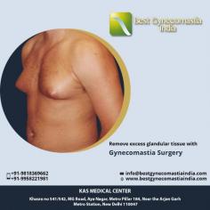 A male breast reduction is the most effective known treatment for gynecomastia, or enlarged male breasts. This cosmetic surgery procedure removes excess fat and glandular tissue to restore a flatter, firmer and more masculine contour to the chest.
Consult your plan for Gynecomastia Surgery with our US Certified Plastic Surgeon via appointment at:
Call: +91 995 8221 981
E-mail: info@bestgynecomastiaindia.com
Whatsapp: +91 928 9988 888 (Whatsapp only)
Web: www.bestgynecomastiaindia.com
#grade3gynecomastiasurgery #gynecomastiasurgery #bestgynecomastiaindia #vaserliposuction #drkashyap
