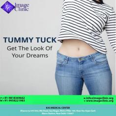 A tummy tuck, or abdominoplasty, is a surgical procedure that improves abdominal contours by removing excess skin and fat and tightening the muscles. 
Contact Dr. Kashyap Clinc at +91-9958221983, 9958221981 to book a consultation.
Visit: https://www.imageclinic.org/abdominoplasty-or-tummy-tuck.html
Now New Address: Khasra no 541/542, MG Road, Aya Nagar, Metro Pillar 184, Near the Arjan Garh Metro Station, New Delhi 110047 (India)
#TummyTuck #Abdominoplasty #Abdomen #Liposuction #Surgery #Fat #CosmeticSurgery #PlasticSurgeon
