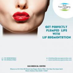 Attractive and sensual lips can enhance your overall personality! If you don’t have, then choose the Lip Augmentation in Delhi today. At the KAS Medical Center, our experienced professionals will revive the shape of your lips; regain the plumpness and volume of the lips. Visit the official website today!
For more info visit www.bestfacesurgeryindia.com or call now on 9958221983 / 82 to book your free consultation.
#LipAugmentation, #LipAugmentationSurgery, #LipAugmentationCost, #LipEnlagermentSurgeon, #Fattransfer, #Filler, #FillerCost, #cosmeticsurgery, #plasticsurgery, #plasticsurgerycost, #LipAugmentationbeforeandafter,#DrAjayaKashyap
