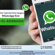 If you have been thinking about getting a liposuction surgery in Delhi contact us for an appointment where we can discuss your requirements in more details. 
Share your #whatsappnumber, contact number or email id to get immediate help. You can also visit www.bestliposuctionindia.com to know details
#PlasticSurgery #Surgery #Transformation #Mommy #Liposuction #Bodyjet #Vaserliposuction #CosmeticSurgeryIndia