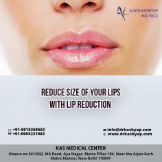 People having large lips and want to reduce their size, or if they have hanging excess skin on the upper lip, then Lip Reduction procedure is best option for them. Book an appointment with Dr. Ajaya Kashyap.
======
For further information regarding Lip Reduction Surgery, please visit our website at www.drkashyap.com or write to us at info@drkashyap.com
Call / Whatsapp TODAY - 91 9818369662, 9958221982, 9958221981
#LipReduction #LipResize #LowerLipReduction #UpperLipReduction #LipSurgery #CosmeticSurgery #PlasticSurgery #CosmeticSurgeon #PlasticSurgeon #MedSpa #DrAjayaKashyap #DrKashyap
