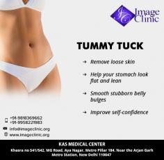 Abdominoplasty is solution for many people who wants to remove excess belly skin and fat and tightening tummy muscles.
To schedule an appointment please call +91-9958221983.
Visit: https://www.imageclinic.org/abdominoplasty-or-tummy-tuck.html
#TummyTuck #Abdominoplasty #DrAjayaKashyap #plasticsurgery #tummy #tummytuckformen #bellyfat

