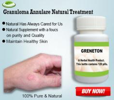 If annoying these Natural Remedies for Granuloma Annulare you feel distasteful and friendly. This inordinate sign shows that your body is curing accurately these tips and Granuloma Annulare Herbal Treatment, you don't have to care about the uninvited side effects as every one of the fixings used are natural and no liquids, lotions, or strange fixings are included.
