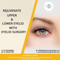 Blepharoplasty popularly called an eye lift reduces bagginess from lower eyelids and removes excess skin from upper eyelids giving a younger fresh look.

For further information regarding Eyelid Surery, please visit our website at www.bestfacesurgeryindia.com or write to us at info@bestfacesurgeryindia.com
