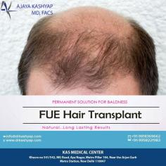 Looking for best Hair Transplant Clinic in Delhi, India? Check the latest FUE & FUT procedure, results, clinic, videos. surgeon & cost of hair transplant at KAS Medical Center.

For any kind of enquire about, hair transplant procedure please complete our contact form https://www.drkashyap.com/cosmetic-plastic-surgery/hair-transplant.html
Call: +91-9818963662, +91-9289988888
#HairTransplant #HairTransplantSurgeon #FUEHairTransplant #Eyebrow #Eyelash #Beard #Moustaches #CosmeticSurgery #PlasticSurgeon #Drkashyap #Delhi #India

