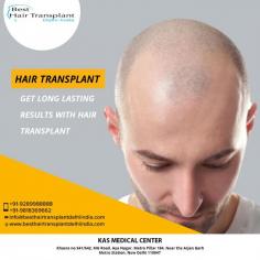 Hair transplants are effective procedures for restoring hair growth following many causes of hair loss. The success rate of hair transplant surgery depends on many factors, including the skill and experience of the surgeon and the thickness of the person’s donor hair.

If you have been thinking about getting a best #hairtransplant surgery in Delhi, #beardhairtransplant cost in India contact us for an appointment where we can discuss your requirements in more details. 

For more info visit www.besthairtransplantdelhiindia.com or call now on +91-9289988888 to book your consultation.

#HairTransplant #BeardHairTransplant #FacialHairTransplant #HairTransplantation #HairTransplantClinic #BeardTransplant
