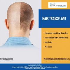 Get back your confidence and self esteem with #HAIRTRANSPLANT. Dr. Ajaya Kashyap uses latest hair transplant technique to ensure that the procedure is copletely safe, painless and does not leave any scars.
======
For further information regarding HAIR TRANSPLANT, please visit our website at www.besthairtransplantdelhiindia.com or write to us at info@besthairtransplantdelhiindia.com
