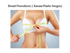 Breast Procedures | Kansas Plastic Surgery

Dr. Schoonover and our team specialize in breast procedures that include breast augmentations, breast reductions, breast lifts and breast reconstructions. Learn more about what the purpose of each procedure is, what to expect before, during and after the procedure and how it can help achieve your reconstructive or aesthetic needs.

For more info, please visit at https://kansasplasticsurgery.com/procedures/breast/