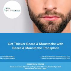 Beard and Moustache contribute to the strong, masculine appearance of the face. Thick growth, groomed well give a nice, neat, impressive look.

Hair Transplant can be performed on the scalp, the beard, eyebrows and moustache area. Hair replacement surgery can enhance your appearance and your self-confidence

For further information regarding HAIR TRANSPLANT, please visit our website at www.besthairtransplantdelhiindia.com or write to us at info@besthairtransplantdelhiindia.com
======
Call / Whatsapp TODAY - 91 9818369662, 9958221982
#KasMedicalCenter #Delhi #India #beardtransplant #hairtransplant #hairreplacement #moustachetransplant #eyebrowtransplant #eyelashtransplant #mesotherapy #hairlosstreatment #prp #EMIoption #plasticsurgery #plasticsurgeon

