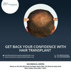 If you want a long term and permanent solution for your baldness, consider hair transplant surgery. 
EMI Available Pay Easy Monthly Instalments
Please call us (+91-9958221983) and inquire (info@drkashyap.com) about the Hair Treatment in Delhi, with Dr. Ajaya Kashyap - your Hair Transplant Surgeon in South Delhi, female hair loss treatment India, hair fall treatment clinic in delhi.
Web: www.besthairtransplantdelhiindia.com
Now New Address: Khasra no 541/542, MG Road, Aya Nagar, Metro Pillar 184, Near the Arjan Garh Metro Station, New Delhi

#HairTransplant #FUE #FUT #HairLoss #PRP #Beard #Moustaches #Eyelash #Eyebrows #PlasticSurgery #Aesthetics #lifestyle #traveling #Hair #Travel #MedicalTourism #Men #Women
