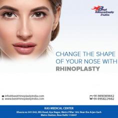 Rhinoplasty (RIE-no-plas-tee) is surgery that changes the shape of the nose. The motivation for rhinoplasty may be to change the appearance of the nose, improve breathing or both.

Contact us anytime with any questions you may have, or to schedule your consultation for Nose surgery in Delhi, India.

CONTACT US:-
Dr. Ajaya Kashyap
WhatsApp:
https://api.whatsapp.com/send?phone=919958221982
Mobile: +91-9818369662, 9958221982
Web: www.bestrhinoplastyindia.com

#nosejob #rhinoplasty #plasticsurgery #nosejobdelhi #nosereshaping #beauty #realself #tipnose
