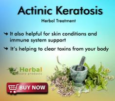 Herbal Treatment for Actinic Keratosis used to treat or reduce the symptoms. Herbal Remedies for Actinic Keratosis can provide relief from the red and rough scaling spots.
https://www.herbal-care-products.com/actinic-keratosis