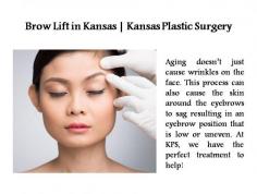 Brow Lift in Kansas | Kansas Plastic Surgery

Aging doesn’t just cause wrinkles on the face. This process can also cause the skin around the eyebrows to sag resulting in an eyebrow position that is low or uneven. At KPS, we have the perfect treatment to help!
For more info, please visit at https://kansasplasticsurgery.com/procedures/face/brow-lift/
